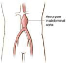 abdominal